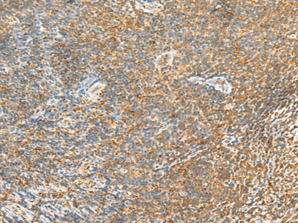 Immunohistochemistry of paraffin-embedded Human tonsil tissue  using MTHFD2L Polyclonal Antibody at dilution of 1:30(?200)