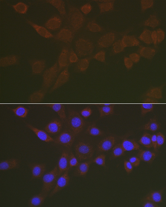 Immunofluorescence analysis of NIH/3T3 cells using NEU3 Polyclonal Antibody at dilution of 1:100 (40x lens). Blue: DAPI for nuclear staining.