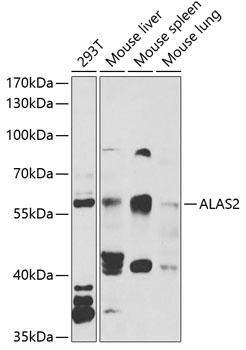 Western blot analysis of extracts of various cell lines using ALAS2 Polyclonal Antibody at 1:1000 dilution.