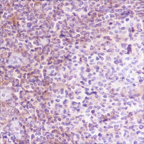 Recombinant VPAC2 Monoclonal Antibody-searchlist-1