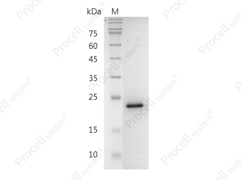 FGF-8a/AIGF/HBGF-8, Human, Recombinant