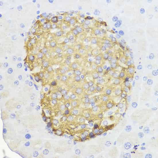 Immunohistochemistry of paraffin-embedded Mouse pancreas using Bcl-2 Polyclonal Antibody at dilution of 1:100 (40x lens).