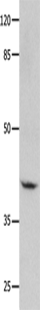 Western Blot analysis of Human leiomyosarcoma tissue using GNA11 Polyclonal Antibody at dilution of 1:450