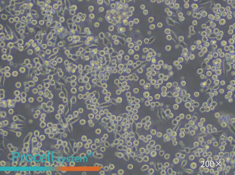 P815 Cell Complete Medium - 6