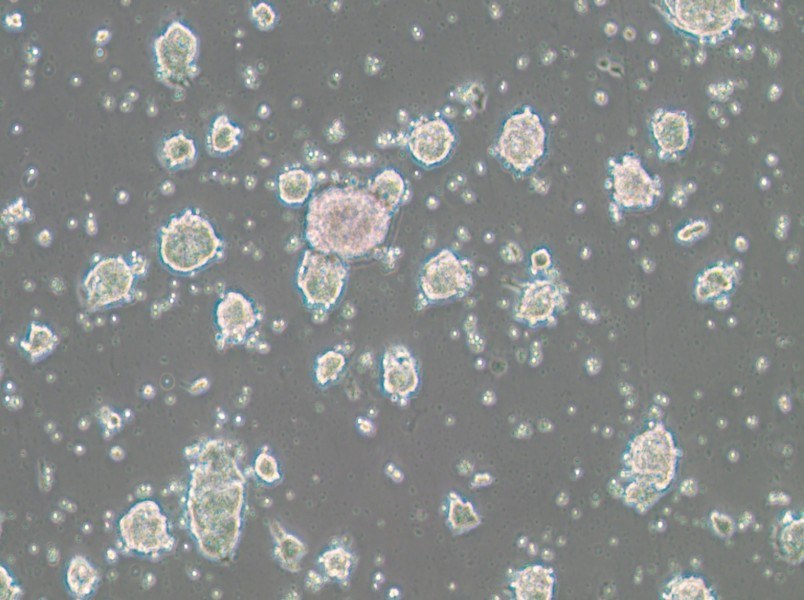 SK-ES-1 Cell Complete Medium - 2