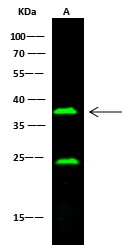 Recombinant CD16/FCGR3 Monoclonal Antibody-searchlist-1