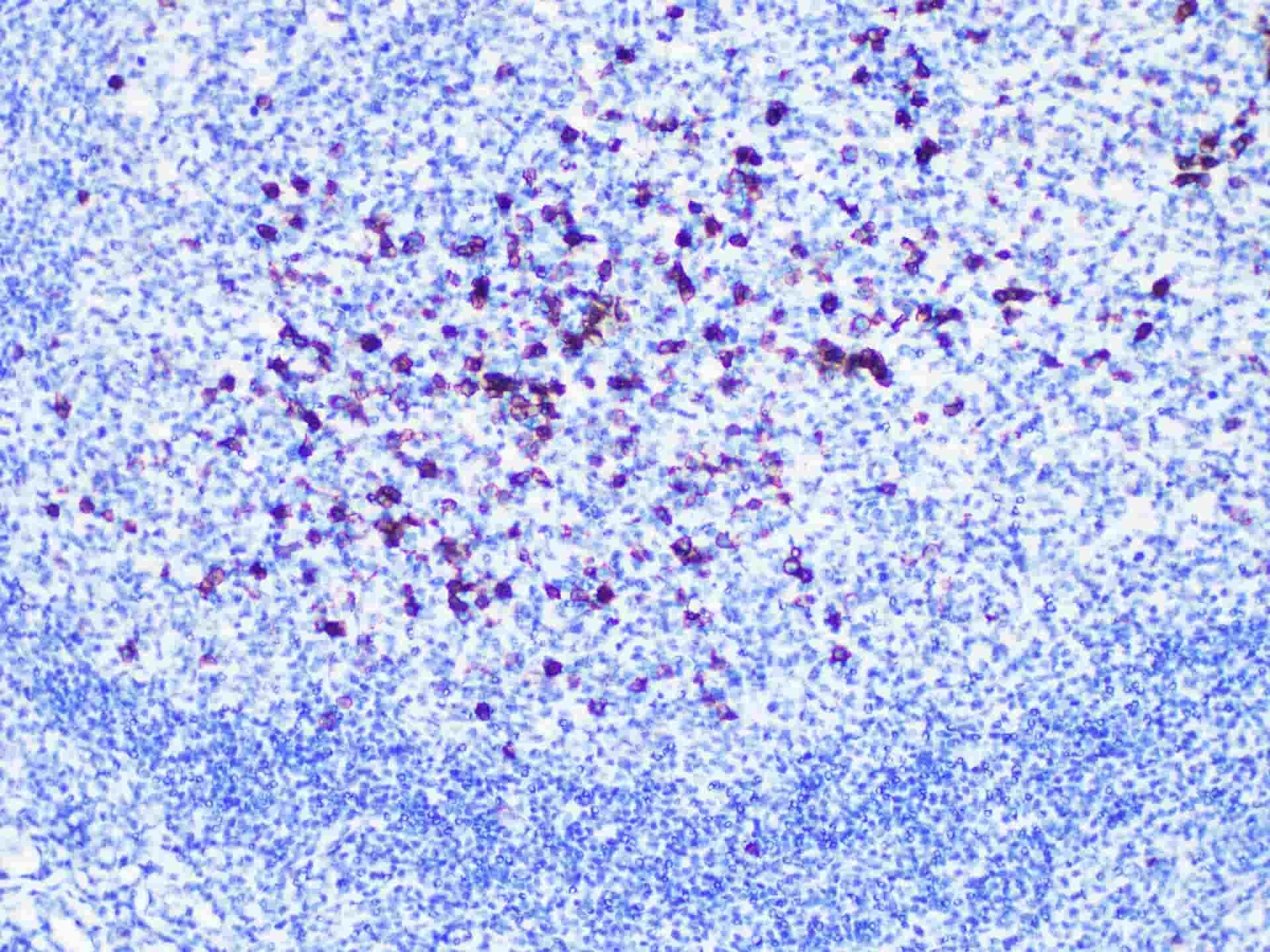 CD38 Monoclonal Antibody-searchlist-1