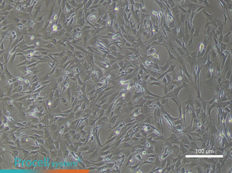 Rat Pulmonary Artery Smooth Muscle Cell Complete MediumRat Pulmonary Artery Smooth Muscle Cell Complete Medium - 3
