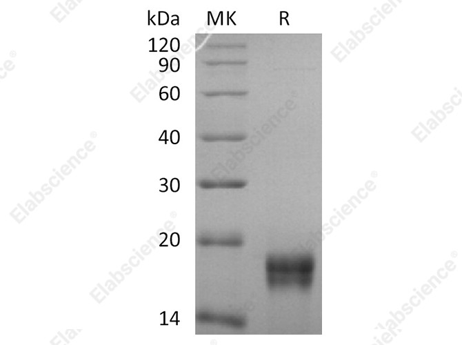 Recombinant Human GADD45β/GADD45B Protein (His Tag) - 1