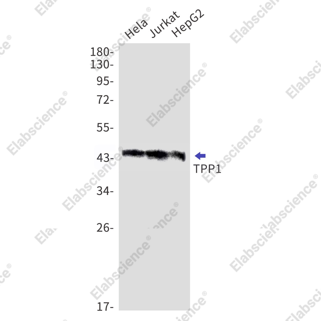 Recombinant TPP1 Monoclonal Antibody - 1