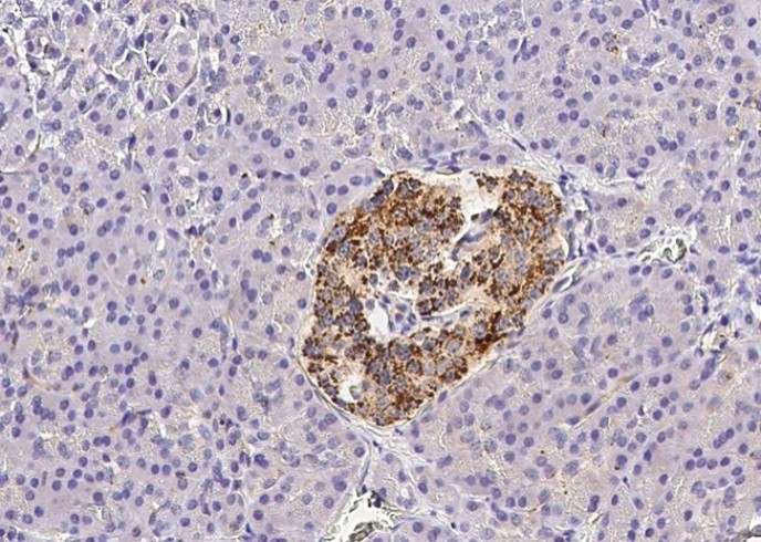 Recombinant Fractalkine/CX3CL1 Monoclonal Antibody - small - 1
