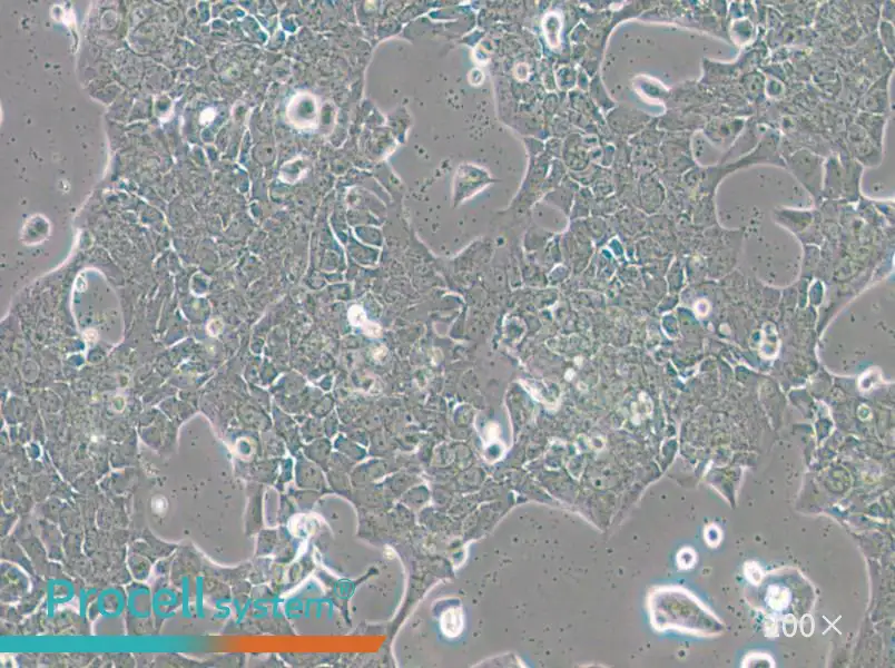 UPCI-SCC-090 Cell Complete Medium - 5