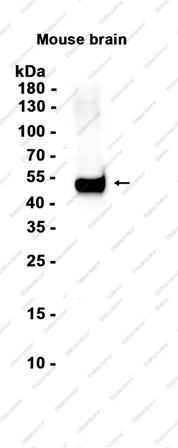 Recombinant beta II Tubulin Monoclonal Antibody - 3