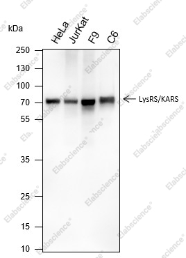 Recombinant LysRS Monoclonal Antibody - 1