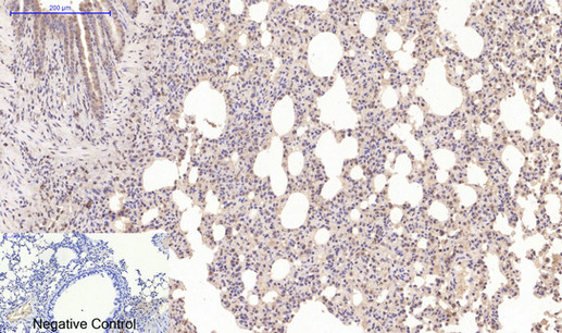 Immunohistochemistry of paraffin-embedded Mouse lung tissue using Desmin Monoclonal Antibody at dilution of 1:200.