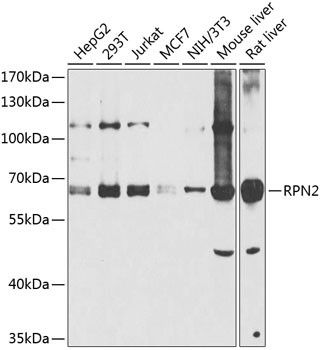 Western blot analysis of extracts of various cell lines using RPN2 Polyclonal Antibody at 1:1000 dilution.