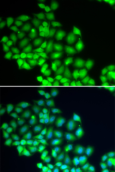 Immunofluorescence analysis of HeLa cells using ERCC2 Polyclonal Antibody