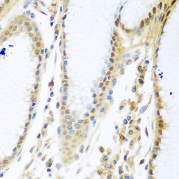 Immunohistochemistry of paraffin-embedded Human stomach using MYBBP1A Polyclonal Antibody at dilution of  1:100 (40x lens).