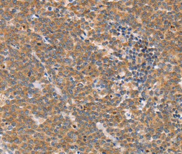 CD2AP Polyclonal Antibody - 2