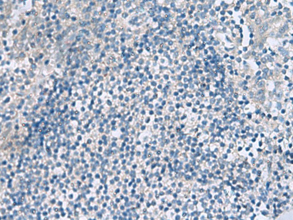 Immunohistochemistry of paraffin-embedded Human tonsil tissue  using HPCAL1 Polyclonal Antibody at dilution of 1:90(?200)