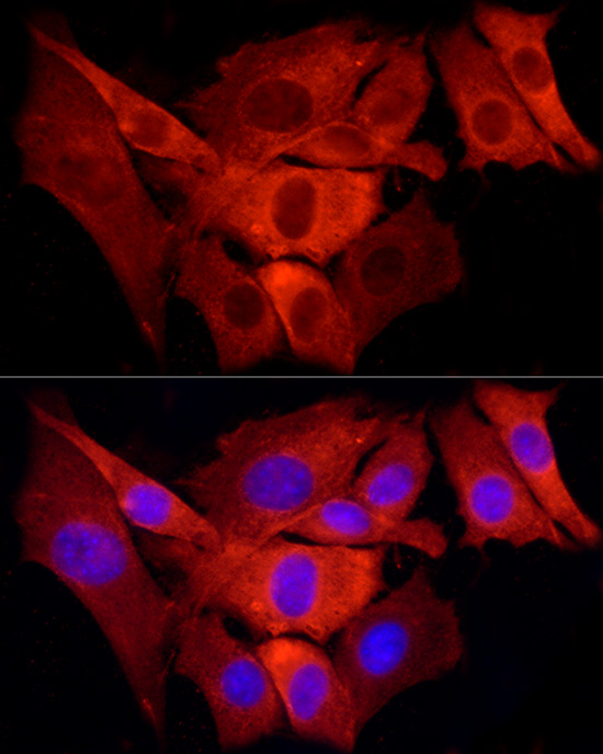 Immunofluorescence analysis of NIH/3T3 cells using TRAF6 Polyclonal Antibody at dilution of 1:100 (40x lens). Blue: DAPI for nuclear staining.