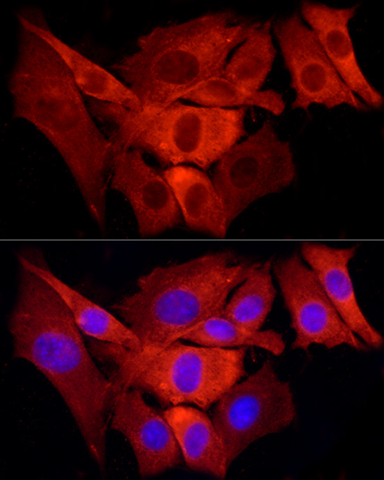 Immunofluorescence analysis of NIH/3T3 cells using TRAF6 Polyclonal Antibody at dilution of 1:100 (40x lens). Blue: DAPI for nuclear staining.