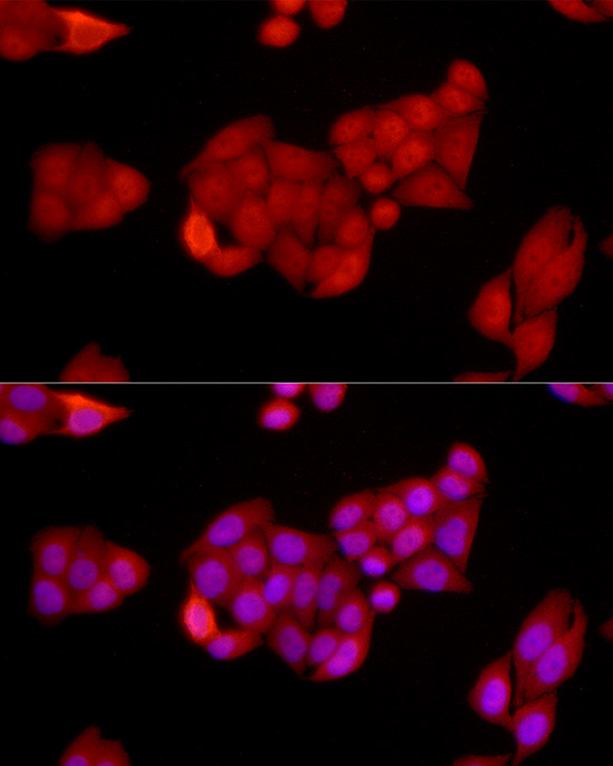 Immunofluorescence analysis of HeLa cells using [KO Validated] SIRT1 Polyclonal Antibody at dilution of 1:250 (40x lens). Blue: DAPI for nuclear staining.