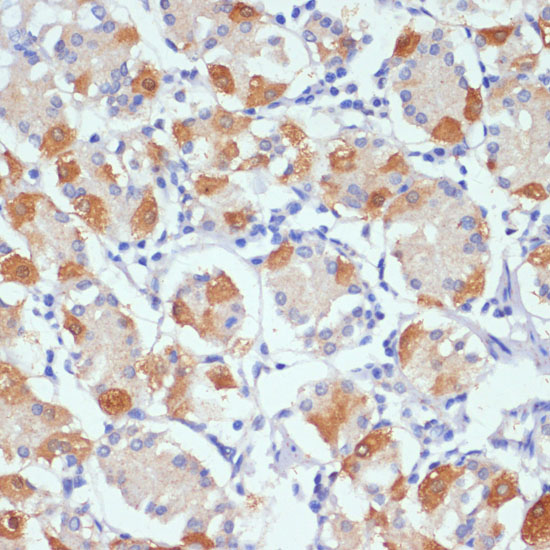 Immunohistochemistry of paraffin-embedded Human stomach using AHR Polyclonal Antibody at dilution of  1:100 (40x lens).