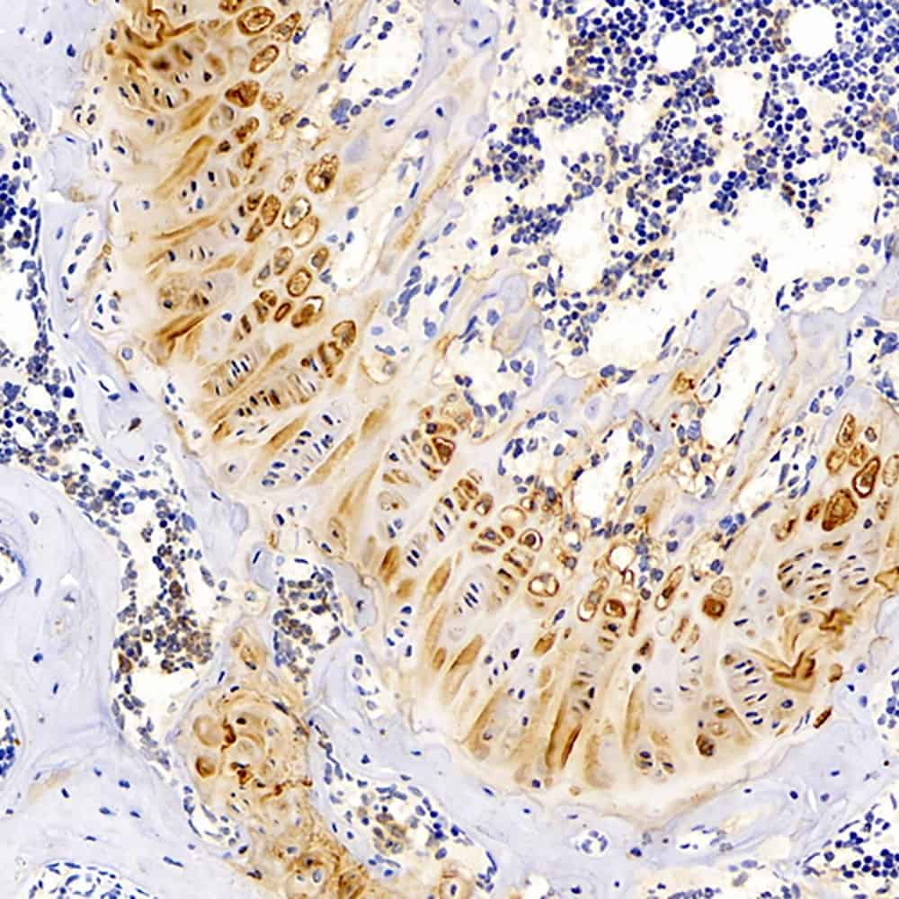 Immunohistochemistry analysis of paraffin-embedded mouse bone  using MAGEC1 Polyclonal Antibody at dilution of 1:300.