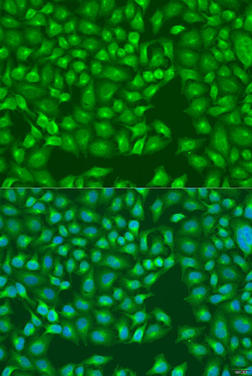 Immunofluorescence analysis of U2OS cells using MERTK Polyclonal Antibody at dilution of  1:100. Blue: DAPI for nuclear staining.