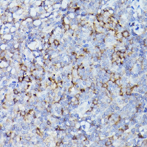 Immunohistochemistry of paraffin-embedded human tonsil using HLA-DQB1 Polyclonal Antibody at dilution of 1:100 (40x lens).Perform high pressure antigen retrieval with 10 mM citrate buffer pH 6.0 before commencing with IHC staining protocol.