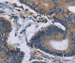 IPO4 Polyclonal Antibody - 3
