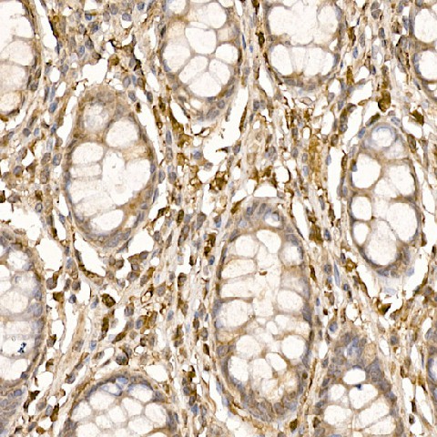 Immunohistochemistry of paraffin-embedded human colon using P23/PTGES3 Polyclonal Antibody at dilution of 1:200 (40x lens).Perform high pressure antigen retrieval with 10 mM citrate buffer pH 6.0 before commencing with IHC staining protocol.