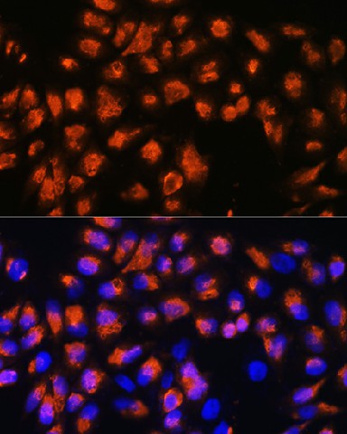 Immunofluorescence analysis of HeLa cells using AGRN Polyclonal Antibody at dilution of 1:100. Blue: DAPI for nuclear staining.