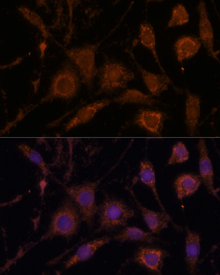 Immunofluorescence analysis of L929 cells using STC1 Polyclonal Antibody at dilution of 1:100. Blue: DAPI for nuclear staining.