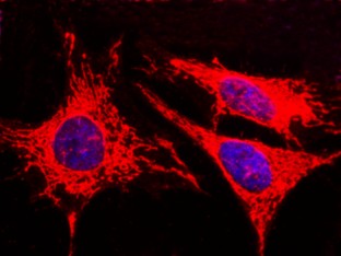 Recombinant AK4/Adenylate Kinase 4/AK3L1 Monoclonal Antibody-searchlist-1