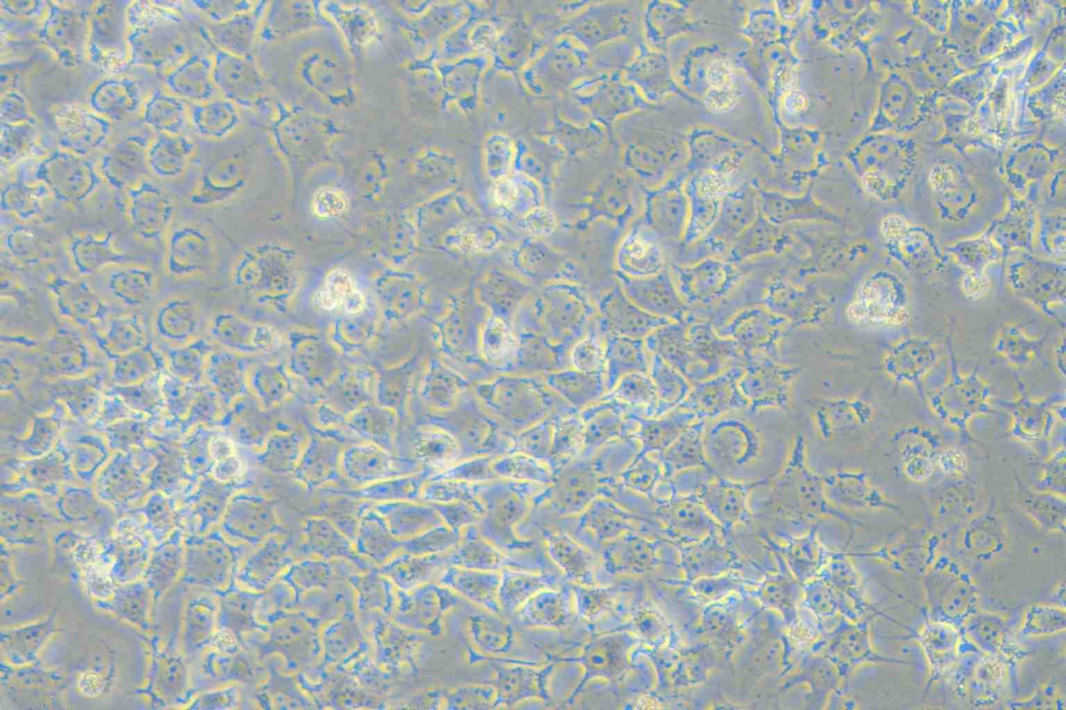 92-1 [Human uveal melanoma] Cell Complete Medium - small - 4