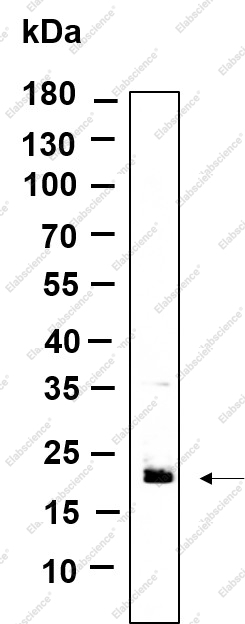 Recombinant RAB7B Monoclonal Antibody - 1