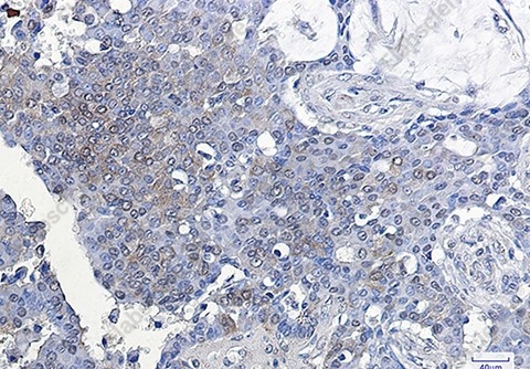 Recombinant ATF5 Monoclonal Antibody - 3