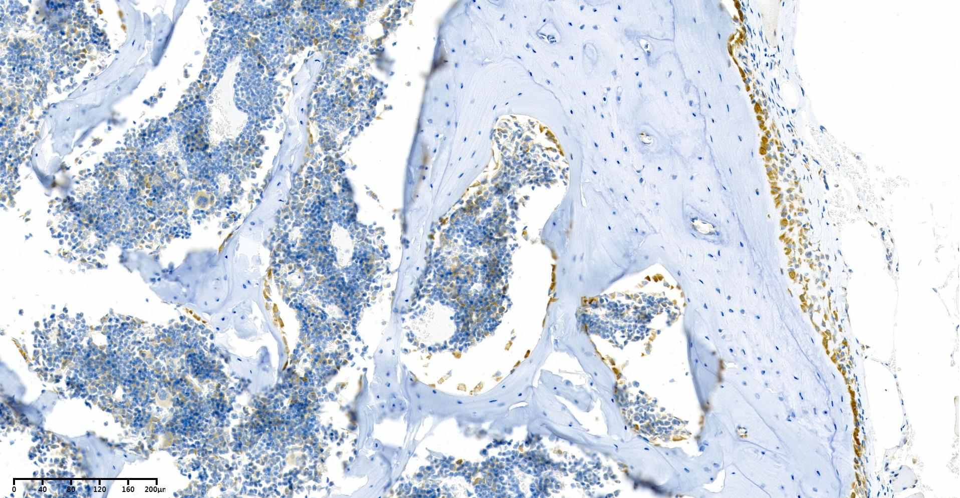Recombinant BMP2 Monoclonal Antibody - 2