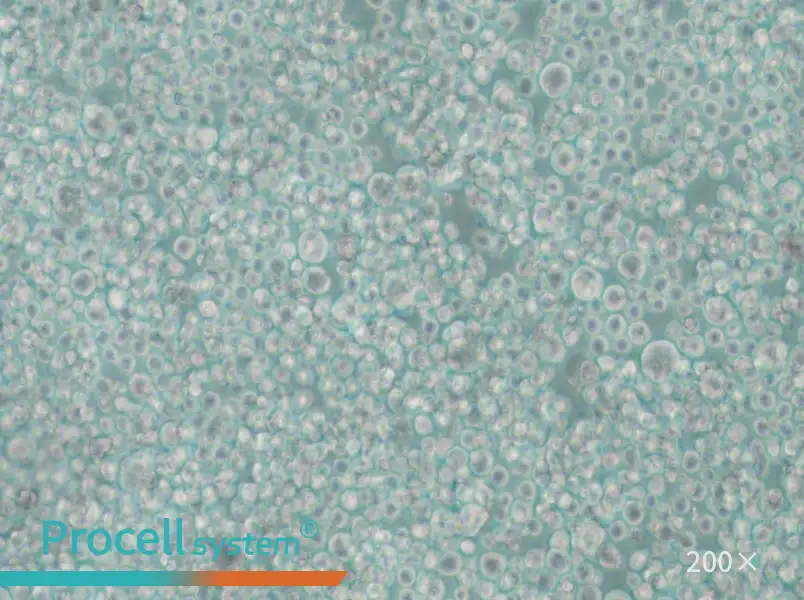 SU-DHL-2 Cell Complete Medium - 5