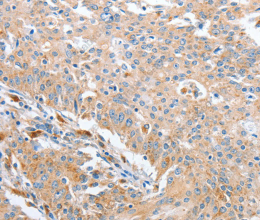 WNT3A Polyclonal Antibody - 3