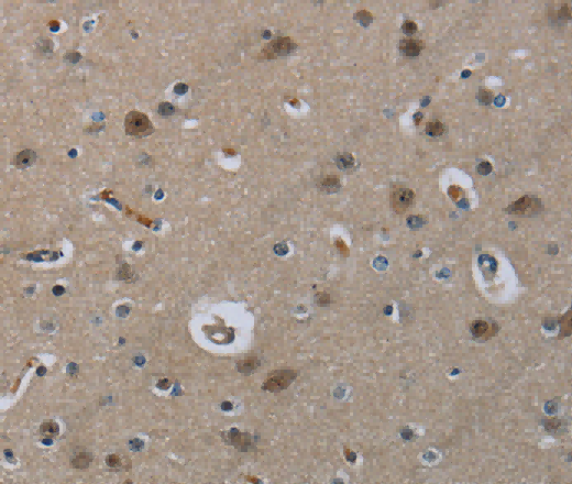 MRE11 Polyclonal Antibody - 3
