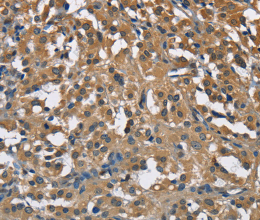 ENO1 Polyclonal Antibody - 3