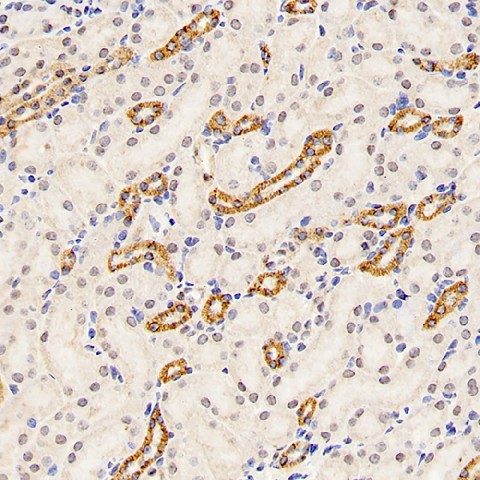 Immunohistochemistry analysis of paraffin-embedded mouse kidney  using Mineralocorticoid receptor Polyclonal Antibody at dilution of 1:300.