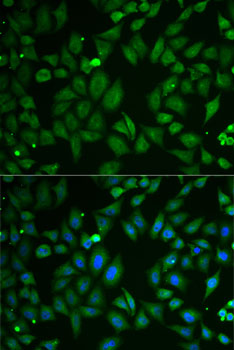 Immunofluorescence analysis of U2OS cells using SCG2 Polyclonal Antibody