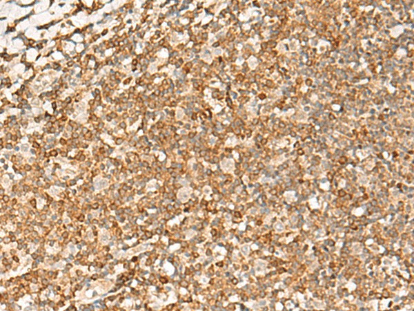 Immunohistochemistry of paraffin-embedded Human tonsil tissue  using PDCD4 Polyclonal Antibody at dilution of 1:35(?200)