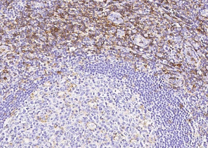 Recombinant PSGL-1/CD162/SELPLG Monoclonal Antibody - 1