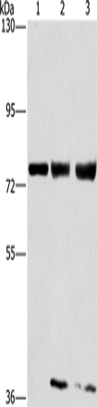 Western Blot analysis of MCF7, hela and 293T cell using GGCX Polyclonal Antibody at dilution of 1:400