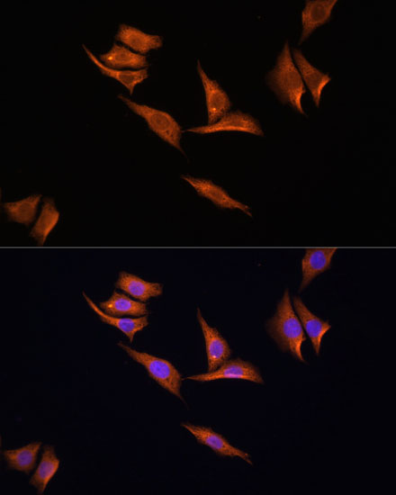 Immunofluorescence analysis of HeLa cells using AMPKalpha2 Polyclonal Antibody at dilution of 1:100 (40x lens). Blue: DAPI for nuclear staining.
